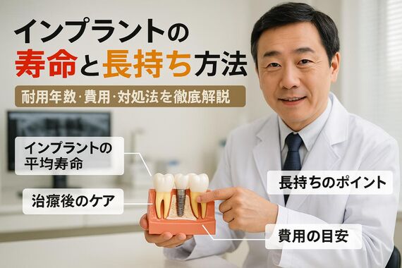 06インプラント 耐用年数